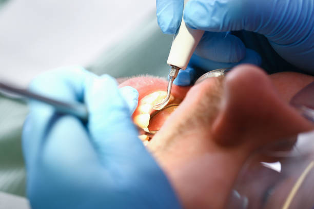 Best Emergency Dental Care for Broken or Chipped Teeth in Mccrory, AR