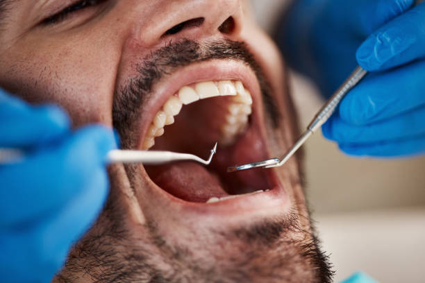 Best Emergency Tooth Extraction in Mccrory, AR