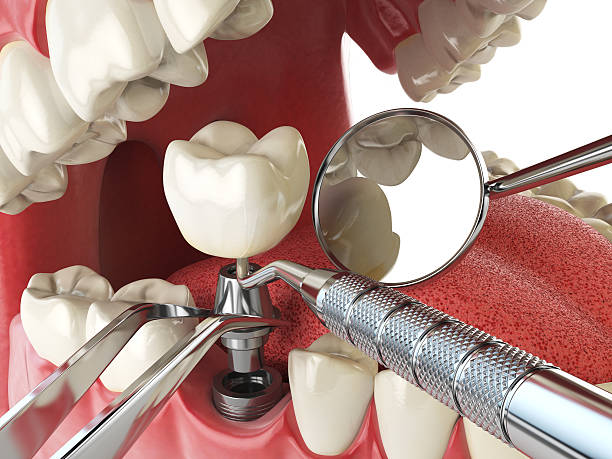 Best Urgent Care for Lost Fillings or Crowns in Mccrory, AR